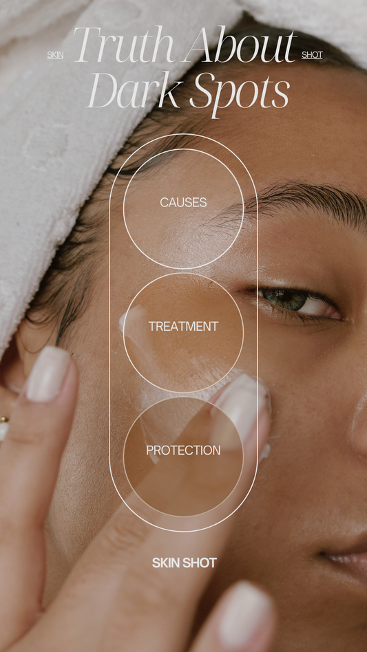 The Truth About Dark Spots: Causes, Treatments & The Power of Glutathione ✨